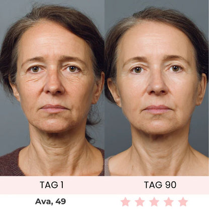 Oreni Sculptura Fibro-Activation™