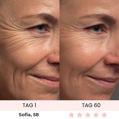 Oreni Sculptura Fibro-Activation™