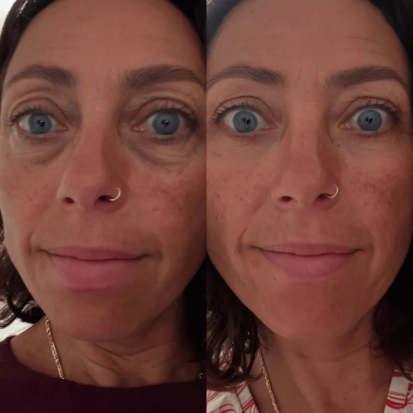 2x Oreni's PDRN Augen Pads | 120 Tages Vorrat