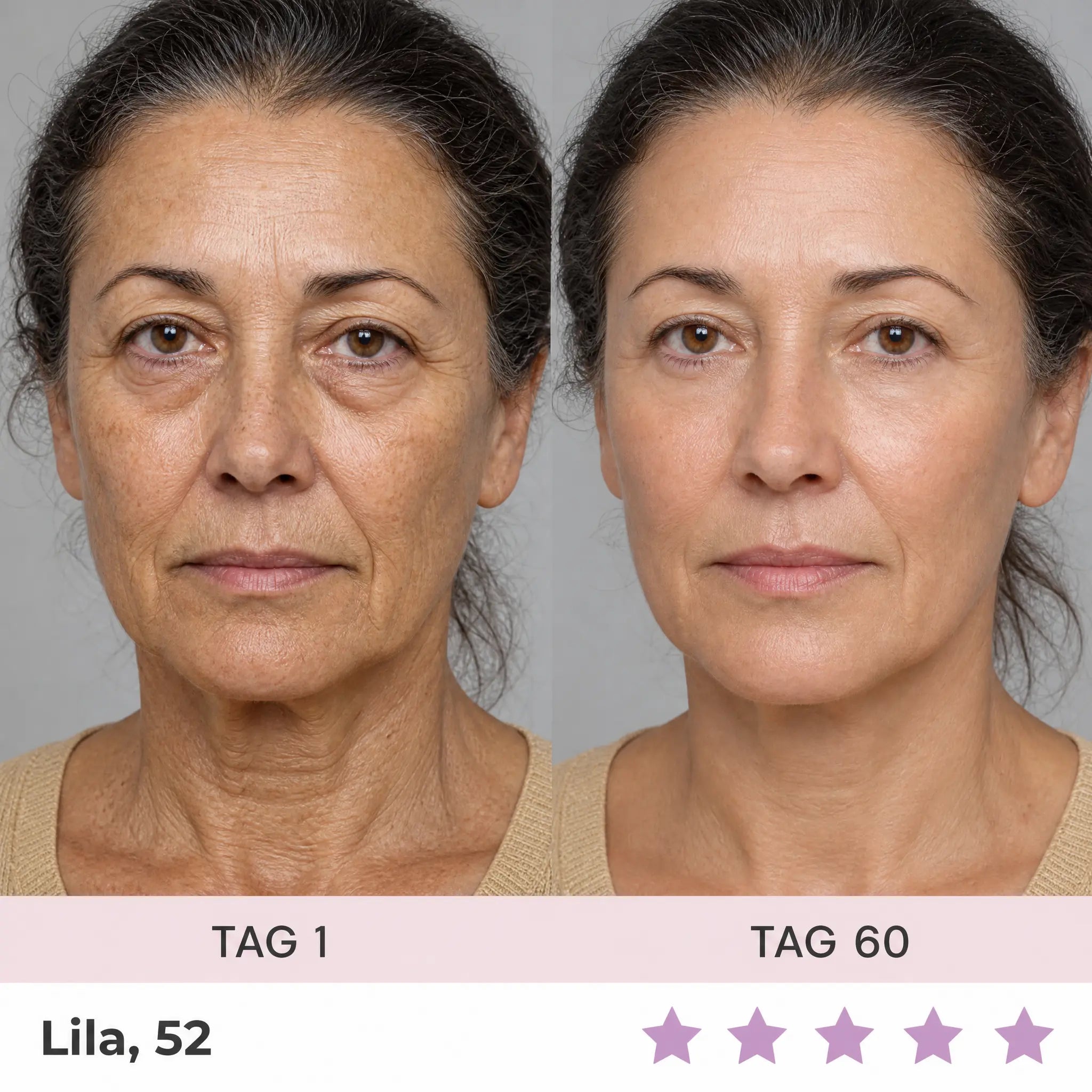 Oreni Sculptura Fibro-Activation™