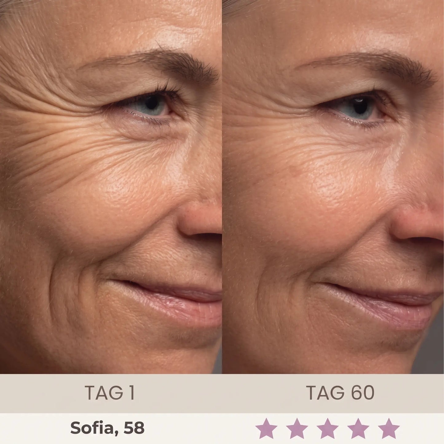 Oreni Sculptura Fibro-Activation™