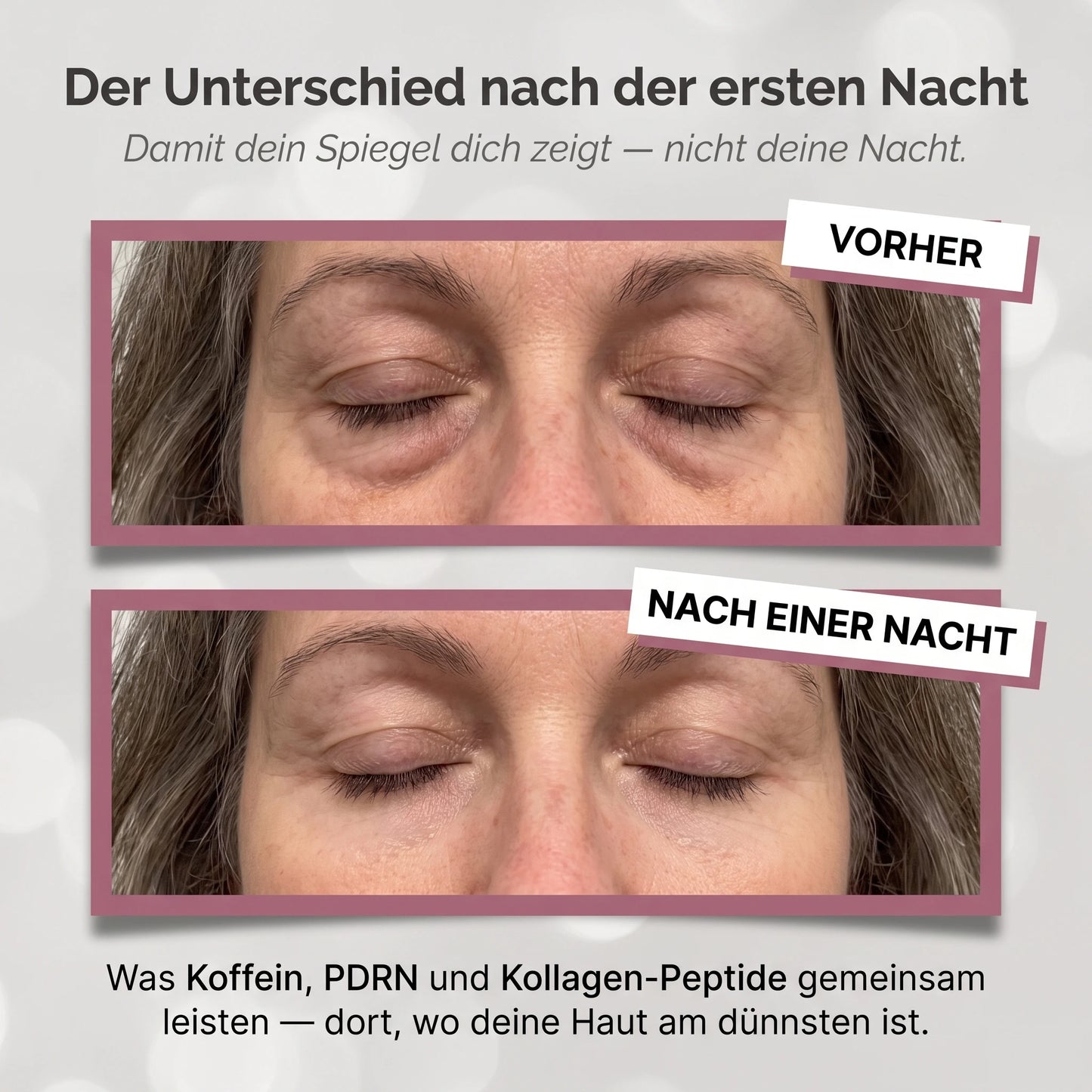 2x Oreni's PDRN Augen Pads | 120 Tages Vorrat